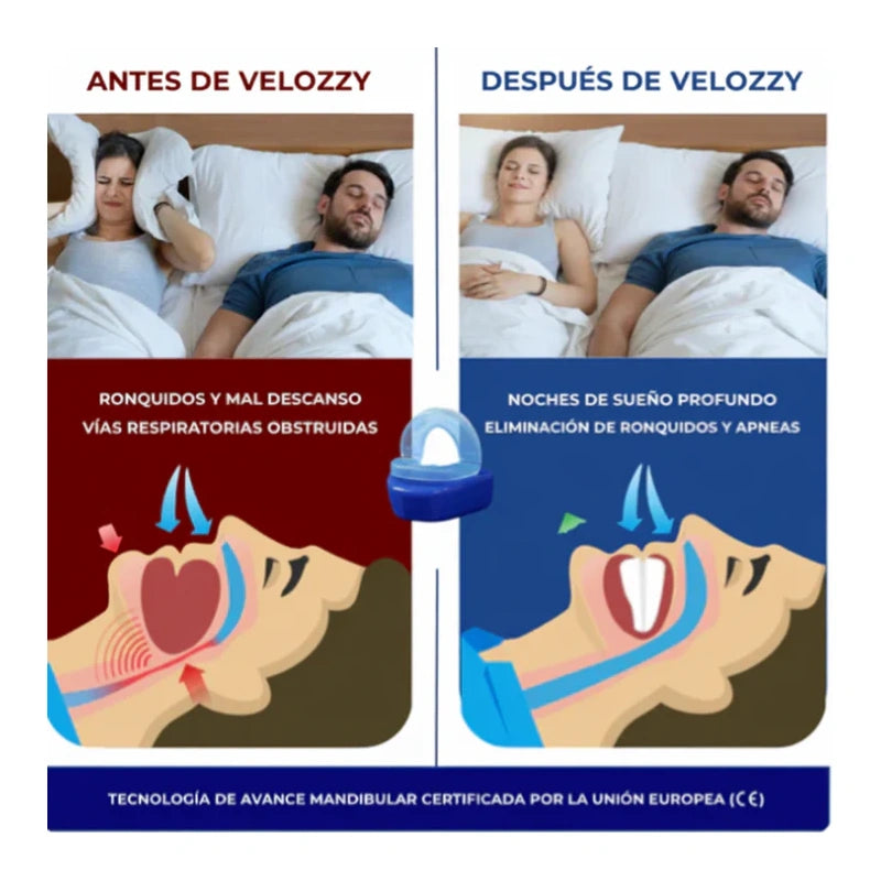 Elimina los ronquidos con Velozzy ™   1+1 GRATIS SOLO HOY